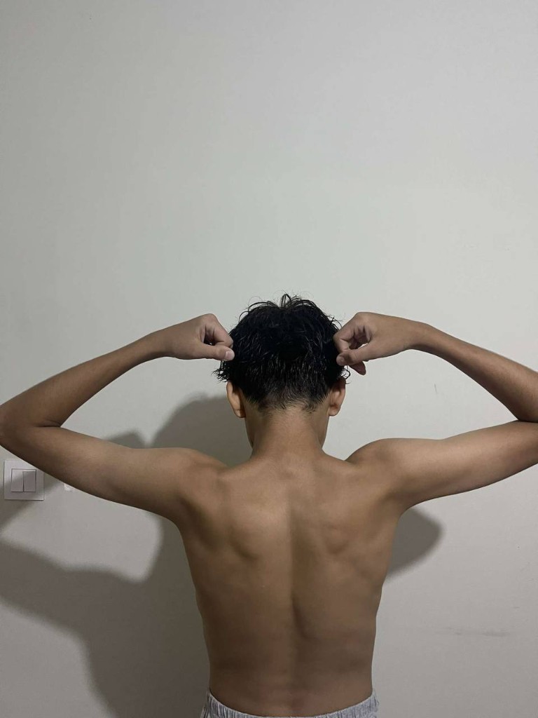 Before transformation
